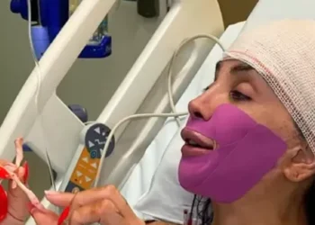 Maya Massafera retira ossos do maxilar em nova cirurgia