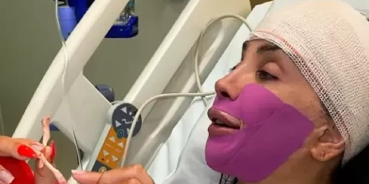 Maya Massafera retira ossos do maxilar em nova cirurgia